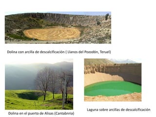 Dolina con arcilla de descalcificación ( Llanos del Pozodón, Teruel) 
Dolina en el puerto de Alisas (Cantabnria) 
Laguna sobre arcillas de descalcificación 
 