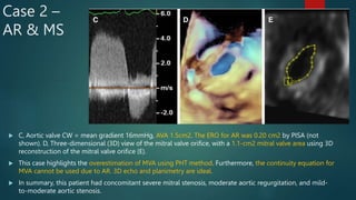 Evaluation of Mixed Valvular Heart Disease on Echo | PPTX