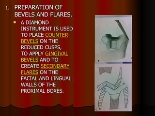 PREPARATION OF  BEVELS AND FLARES. A DIAMOND INSTRUMENT IS USED TO PLACE  COUNTER BEVELS  ON THE REDUCED CUSPS,  TO APPLY  GINGIVAL BEVELS  AND TO CREATE  SECONDARY FLARES  ON THE FACIAL AND LINGUAL WALLS OF THE PROXIMAL BOXES.  