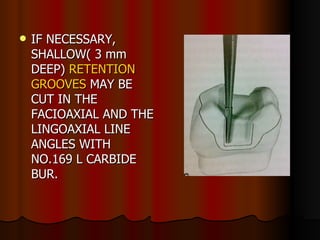 IF NECESSARY, SHALLOW( 3 mm DEEP)  RETENTION GROOVES  MAY BE CUT IN THE FACIOAXIAL AND THE LINGOAXIAL LINE ANGLES WITH NO.169 L CARBIDE BUR.  