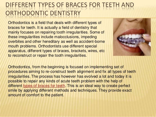 different types of braces for adultswim