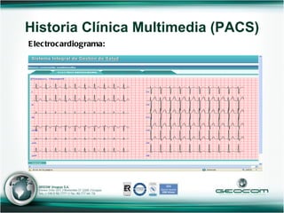 Electrocardiograma: Historia Clínica Multimedia (PACS) 