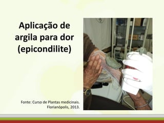 Aplicação de
argila para dor
(epicondilite)
Fonte: Curso de Plantas medicinais.
Florianópolis, 2013.
 