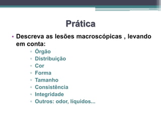 PráticaDescreva as lesões macroscópicas , levando em conta:Órgão DistribuiçãoCorFormaTamanhoConsistênciaIntegridade Outros: odor, líquidos...