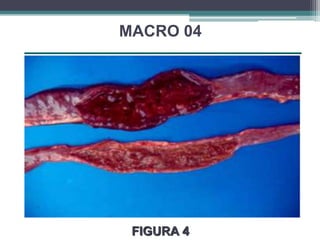 MACRO 04FIGURA 4