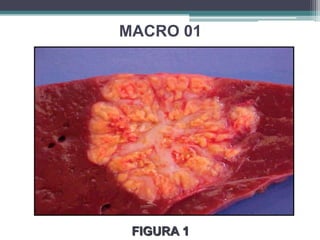 MACRO 01FIGURA 1