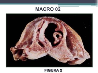 MACRO02FIGURA 2