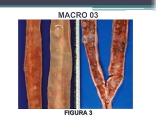 MACRO 03FIGURA 3