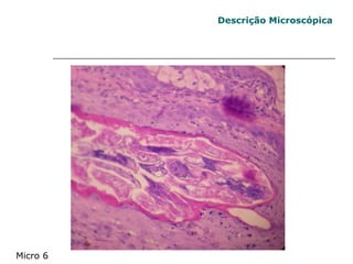 Descrição Microscópica Micro 6 