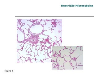 Descrição Microscópica Micro 1 