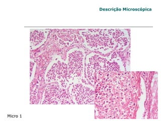 Micro 1 Descrição Microscópica 