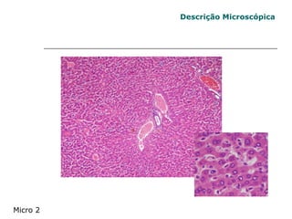 Descrição Microscópica Micro 2 