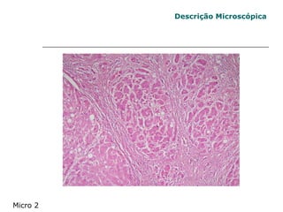 Micro 2 Descrição Microscópica 