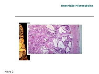 Descrição Microscópica Micro 3 