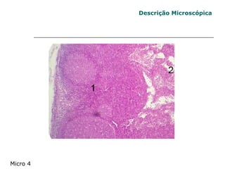 Descrição Microscópica Micro 4 