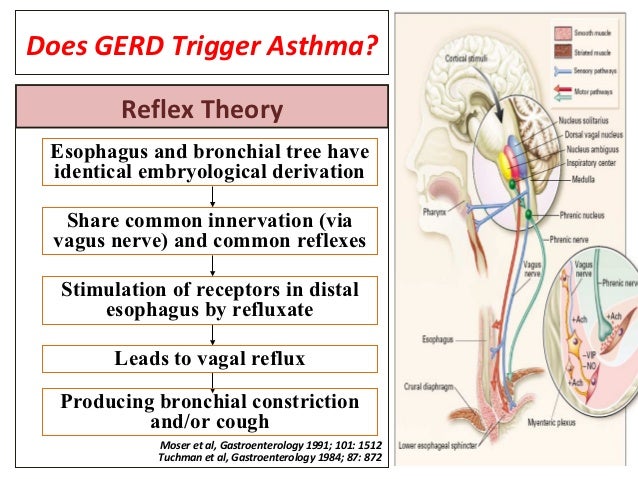 Associated typical symptoms of GERD• Nocturnal cough• Difficult to control asthma; 29.