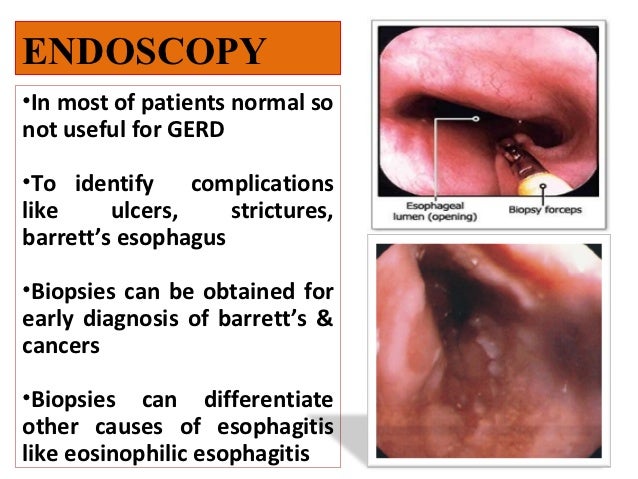 Normal gastric emptying time children