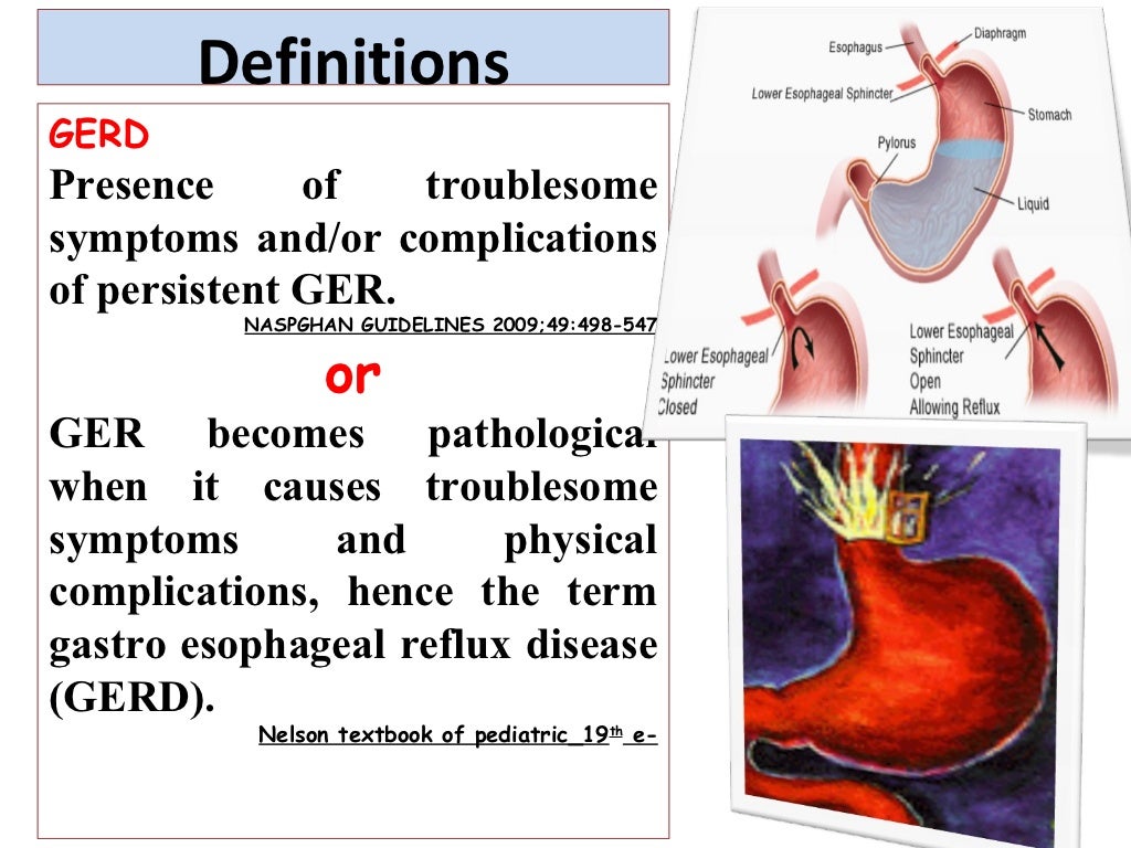 GERD IN CHILDREN