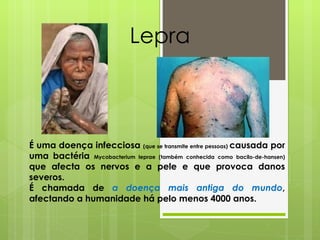 Lepra É uma doença infecciosa  (que se transmite entre pessoas)  causada por uma bactéria  Mycobacterium leprae (também conhecida como bacilo-de-hansen)  que afecta os nervos e a pele e que provoca danos severos.  É chamada de  a doença mais antiga do mundo , afectando a humanidade há pelo menos 4000 anos. 