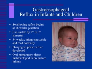 Gastroesophageal Reflux in Infants and Children ,[object Object],[object Object],[object Object],[object Object],[object Object]