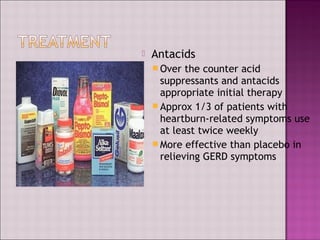 Antacids
 Over the counter acid
suppressants and antacids
appropriate initial therapy
 Approx 1/3 of patients with
heartburn-related symptoms use
at least twice weekly
 More effective than placebo in
relieving GERD symptoms
 