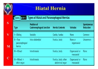 S
V
HiatalHiatal HerniaHernia
V
M
C
 