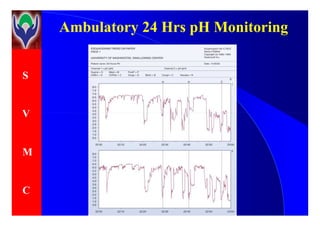 S
V
Ambulatory 24 Hrs pH MonitoringAmbulatory 24 Hrs pH Monitoring
V
M
C
 