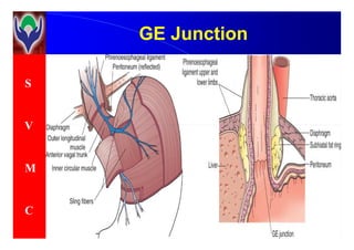 S
V
GE JunctionGE Junction
V
M
C
 