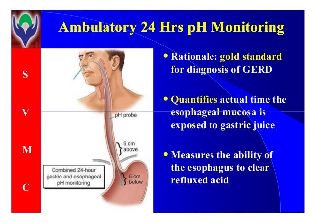 Gastroesophageal reflux disorder- GERD