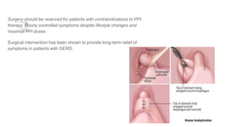 Surgery should be reserved for patients with contraindications to PPI
therapy. Poorly controlled symptoms despite lifestyle changes and
maximal PPI doses.
Surgical intervention has been shown to provide long-term relief of
symptoms in patients with GERD.
 