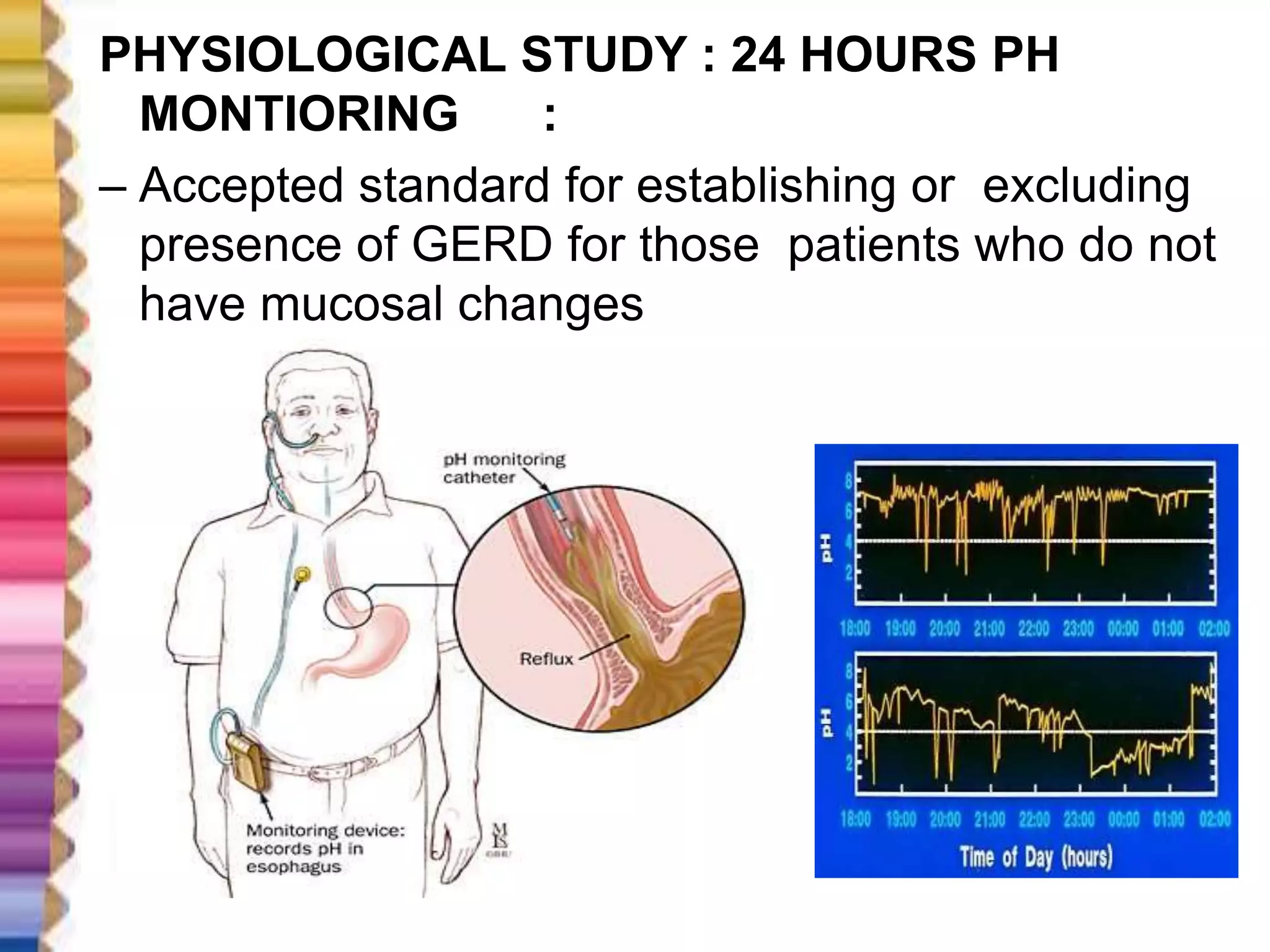 GASTRO ESOPHAGEAL REFLUX DISEASE | PPTX