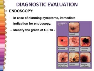 Gerd Testing Explained GASTRO ESOPHAGEAL REFLUX DISEASE | PPTX