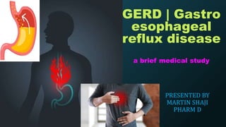 GERD | Gastro
esophageal
reflux disease
a brief medical study
PRESENTED BY
MARTIN SHAJI
PHARM D
 