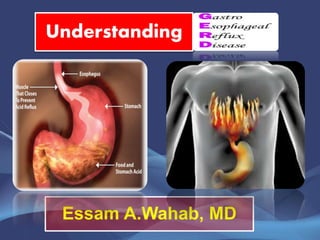 Understanding
Essam A.Wahab, MD
 