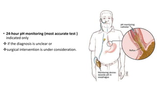• 24-hour pH monitoring (most accurate test )
indicated only
 if the diagnosis is unclear or
surgical intervention is under consideration.
 