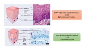 STRATIFIED SQUAMOUS EPITHELIAL
CELLS
Eg Oesophageal mucosa
SIMPLE COLUMNAR EPITHELIAL
CELLS
Eg Stomach mucosa
 
