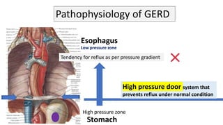 Gerd Body System gerd.pptx