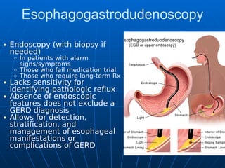 Esophagogastrodudenoscopy
Endoscopy (with biopsy if
needed)
In patients with alarm
signs/symptoms
Those who fail medication trial
Those who require long-term Rx
Lacks sensitivity for
identifying pathologic reflux
Absence of endoscopic
features does not exclude a
GERD diagnosis
Allows for detection,
stratification, and
management of esophageal
manifestations or
complications of GERD
 