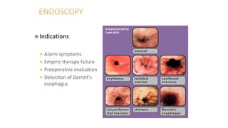  Indications
 Alarm symptoms
 Empiric therapy failure
 Preoperative evaluation
 Detection of Barrett’s
esophagus
 