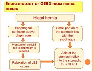 ETIOPATHOLOGY OF GERD FROM HIATAL 
HERNIA 
Hiatal hernia 
Small portion of 
the stomach lies 
with the 
esophagus 
Esophageal 
sphincter above 
diaphragm 
Pressure on the LES 
due to diaphragm is 
reduced 
Relaxation of LES 
occurs 
Acid of the 
stomach reflux 
into the stomach, 
thus GERD 
 
