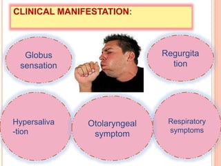 CLINICAL MANIFESTATION: 
Globus 
sensation 
Hypersaliva 
-tion 
Regurgita 
tion 
Respiratory 
symptoms 
Otolaryngeal 
symptom 
 