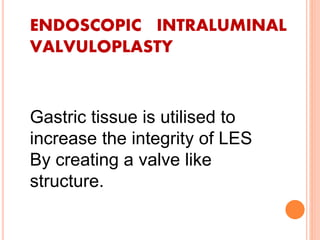 ENDOSCOPIC INTRALUMINAL 
VALVULOPLASTY 
Gastric tissue is utilised to 
increase the integrity of LES 
By creating a valve like 
structure. 
 
