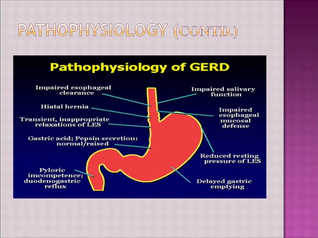 Gastro esophageal Reflux Disease (GERD) and its management | PPT