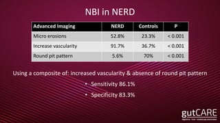 NBI in NERD
Using a composite of: increased vascularity & absence of round pit pattern
• Sensitivity 86.1%
• Specificity 83.3%
Advanced Imaging NERD Controls P
Micro erosions 52.8% 23.3% < 0.001
Increase vascularity 91.7% 36.7% < 0.001
Round pit pattern 5.6% 70% < 0.001
 