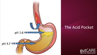 The Acid Pocket
 