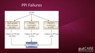 PPI Failures
31
 