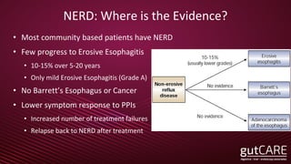 NERD: Where is the Evidence?
• Most community based patients have NERD
• Few progress to Erosive Esophagitis
• 10-15% over 5-20 years
• Only mild Erosive Esophagitis (Grade A)
• No Barrett’s Esophagus or Cancer
• Lower symptom response to PPIs
• Increased number of treatment failures
• Relapse back to NERD after treatment
 