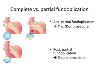 Dor Operation gerddrsendhil-stomach system gut splinter.pdf