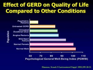 GERD,UNDERSTANDING | PPTX