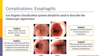 Tops Classification System GERD Management recent advances.pptx